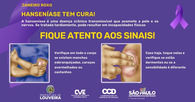 Hanseníase - descubra quais são aa causas, sintomas e tratamento 